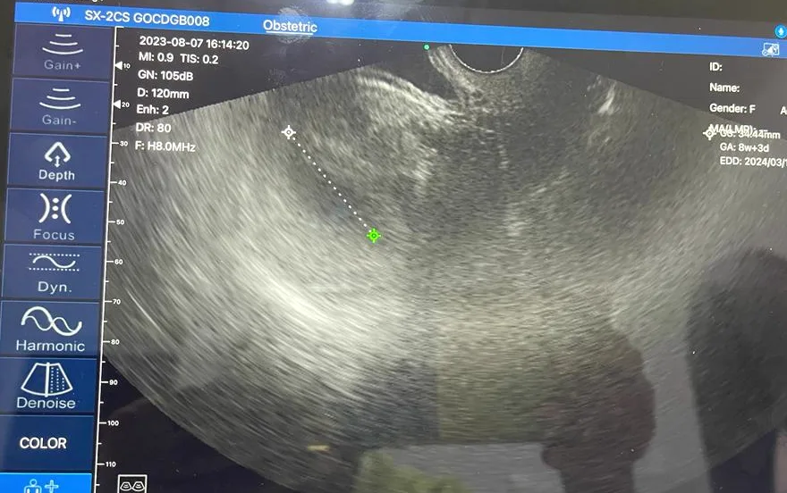 Gynecology ultrasound