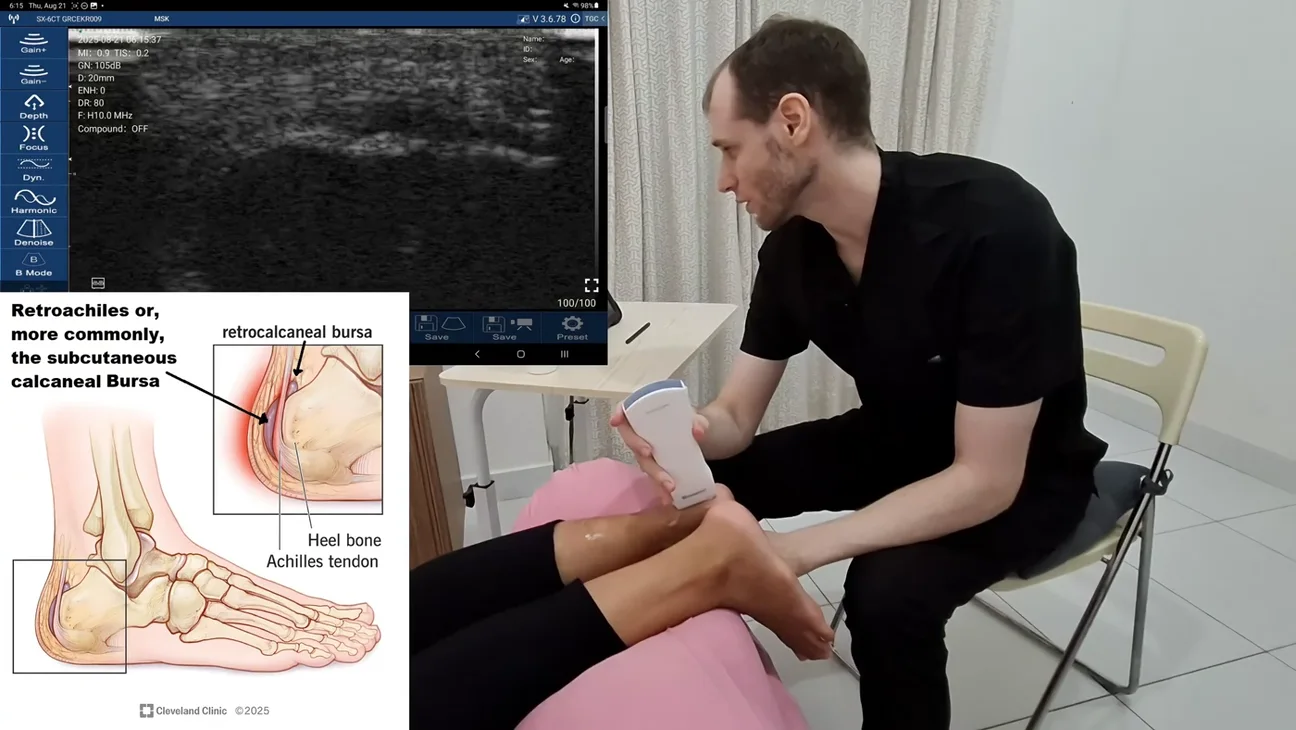 Musculoskeletal (MSK) Medicine ultrasound key frame