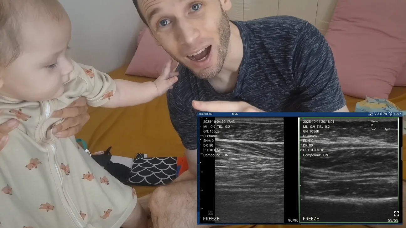 Neonatology ultrasound key frame
