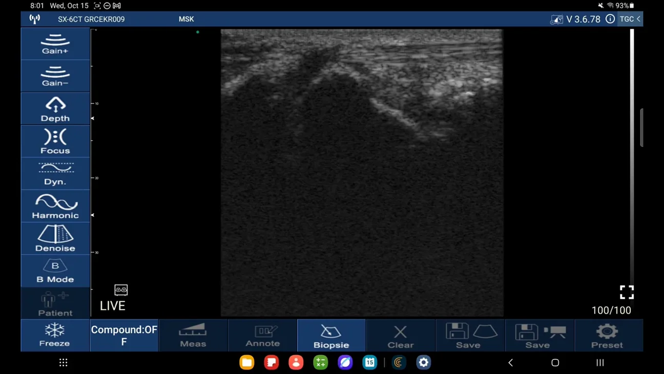 Orthopedic Surgery ultrasound key frame
