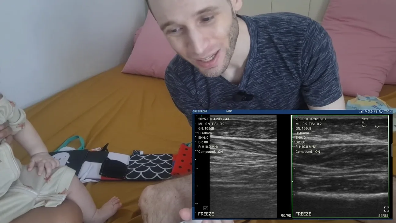 Pediatrics ultrasound key frame