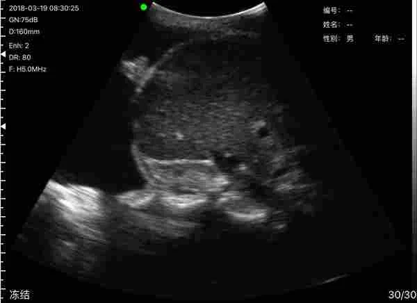 Pulmonology ultrasound key frame