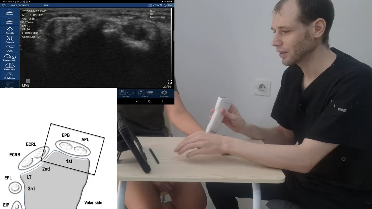 Rheumatology ultrasound key frame