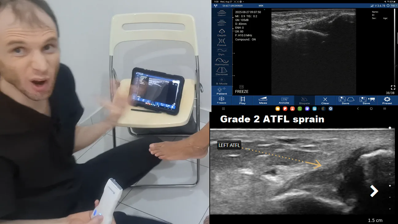 Sports Medicine ultrasound key frame