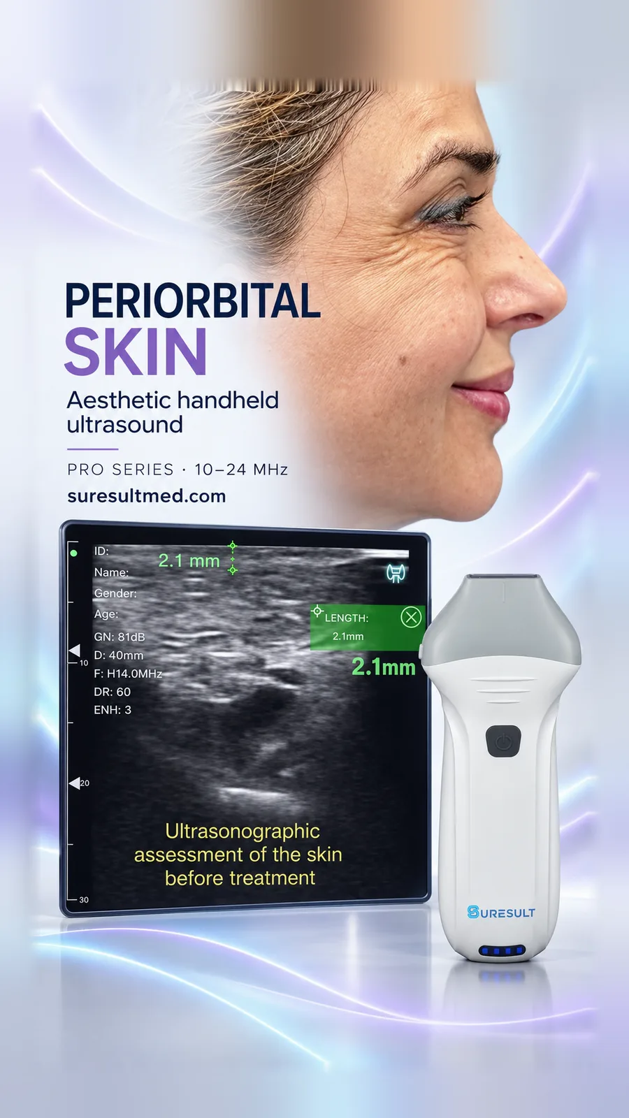 Periorbitale huiddikte, voor/na · B-mode · Pro Series scanvoorbeeld