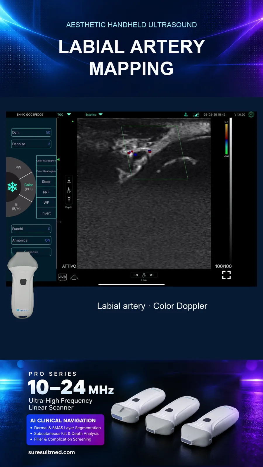 In kaart brengen van de arteria labialis · kleurendoppler · Pro Series scanvoorbeeld
