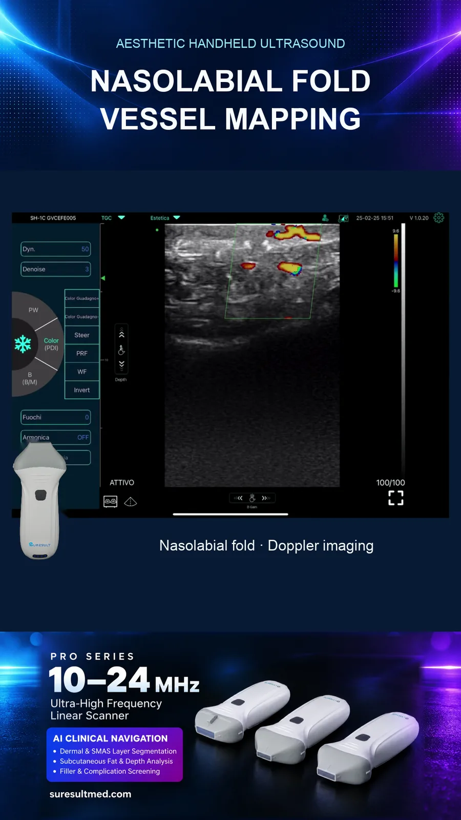 Vaten nasolabiale plooi · kleurendoppler · Pro Series-scanvoorvertoning