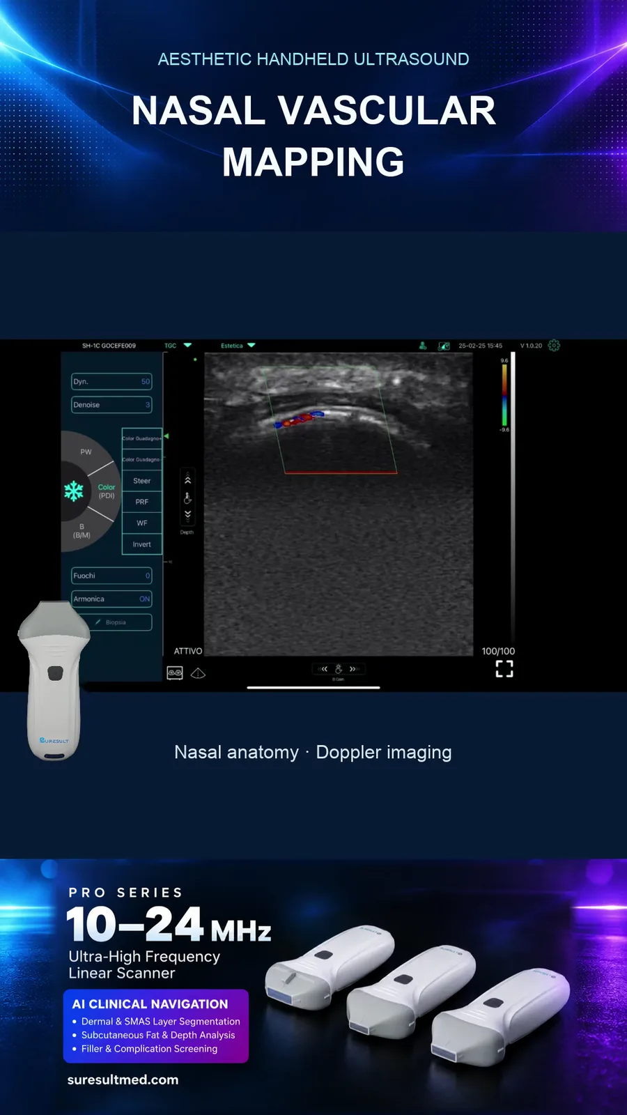 Vaten over het neusbeen · Kleurendoppler · Pro Series scanvoorbeeld