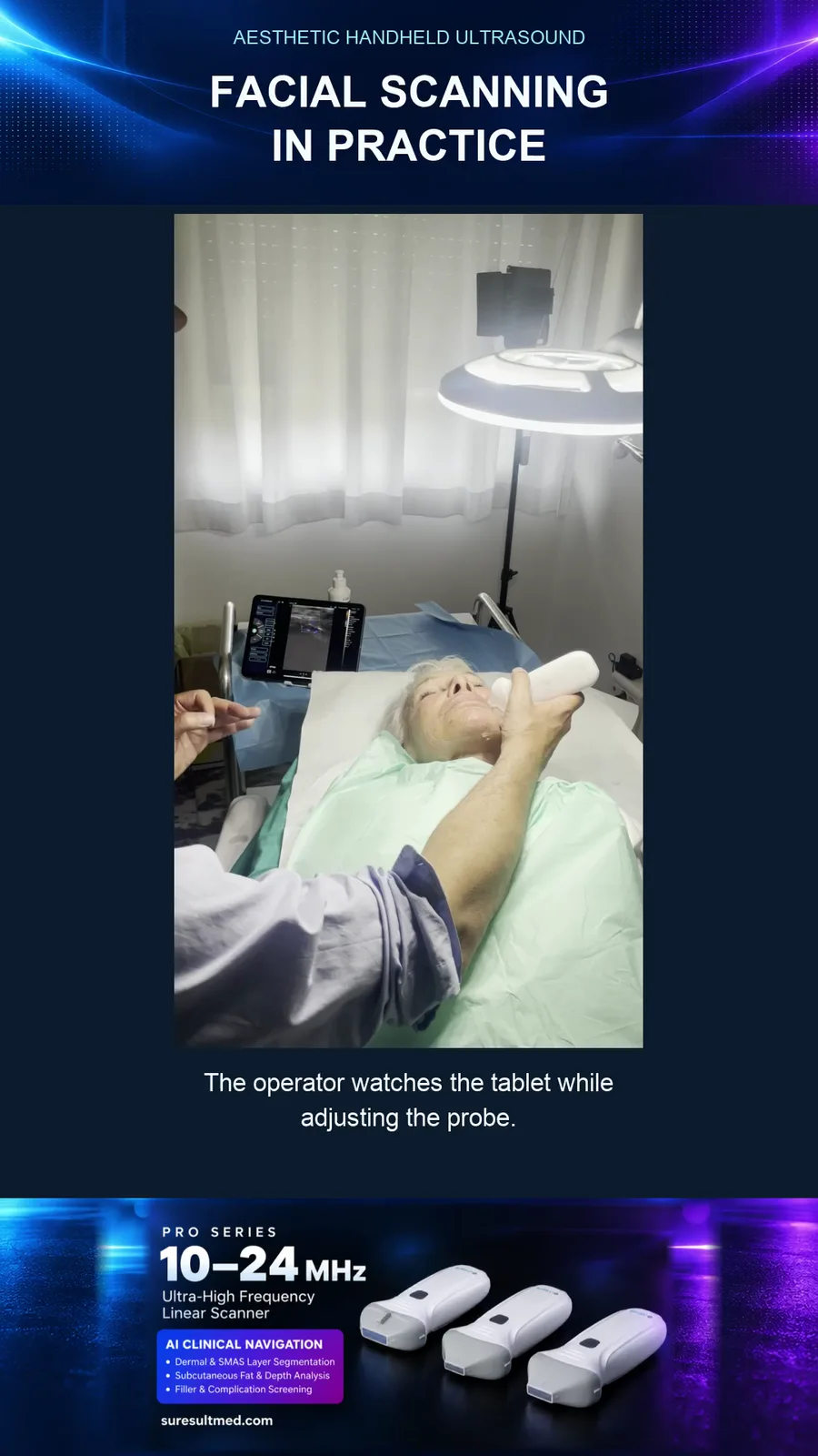 Faciale probepositionering · Kleurendoppler · Pro Series scanvoorbeeld