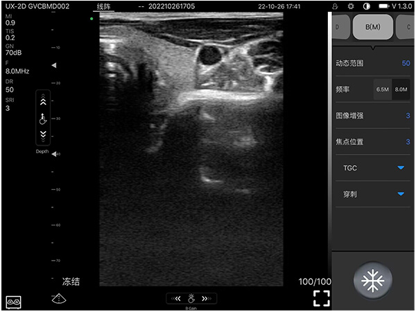 Thyroid and neck vessels · Color Doppler · D2T · Linear probe scan preview