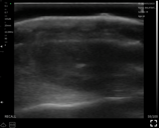 Scalp soft tissue · B-mode · L24Pro · 10 MHz scan preview