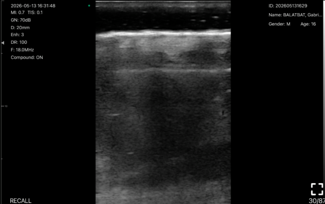 Scalp soft tissue · B-mode · L24Pro · 18 MHz scan preview