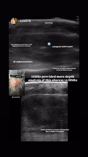 Scalp soft tissue · B-mode · L24Pro · Linear probe scan preview
