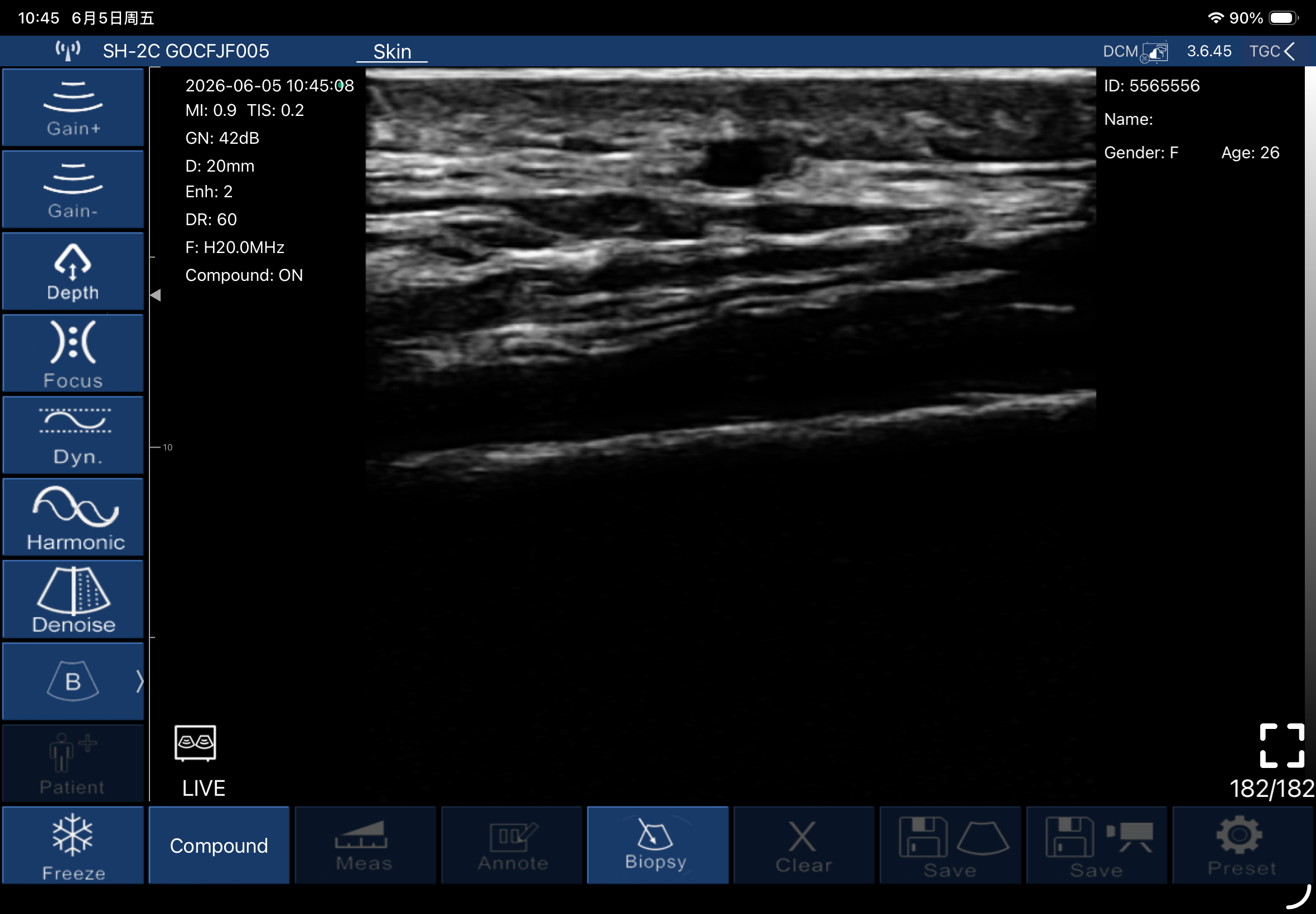 Epidermis, dermis and hypodermis 2 · B-mode · L20Pro · Linear probe scan preview