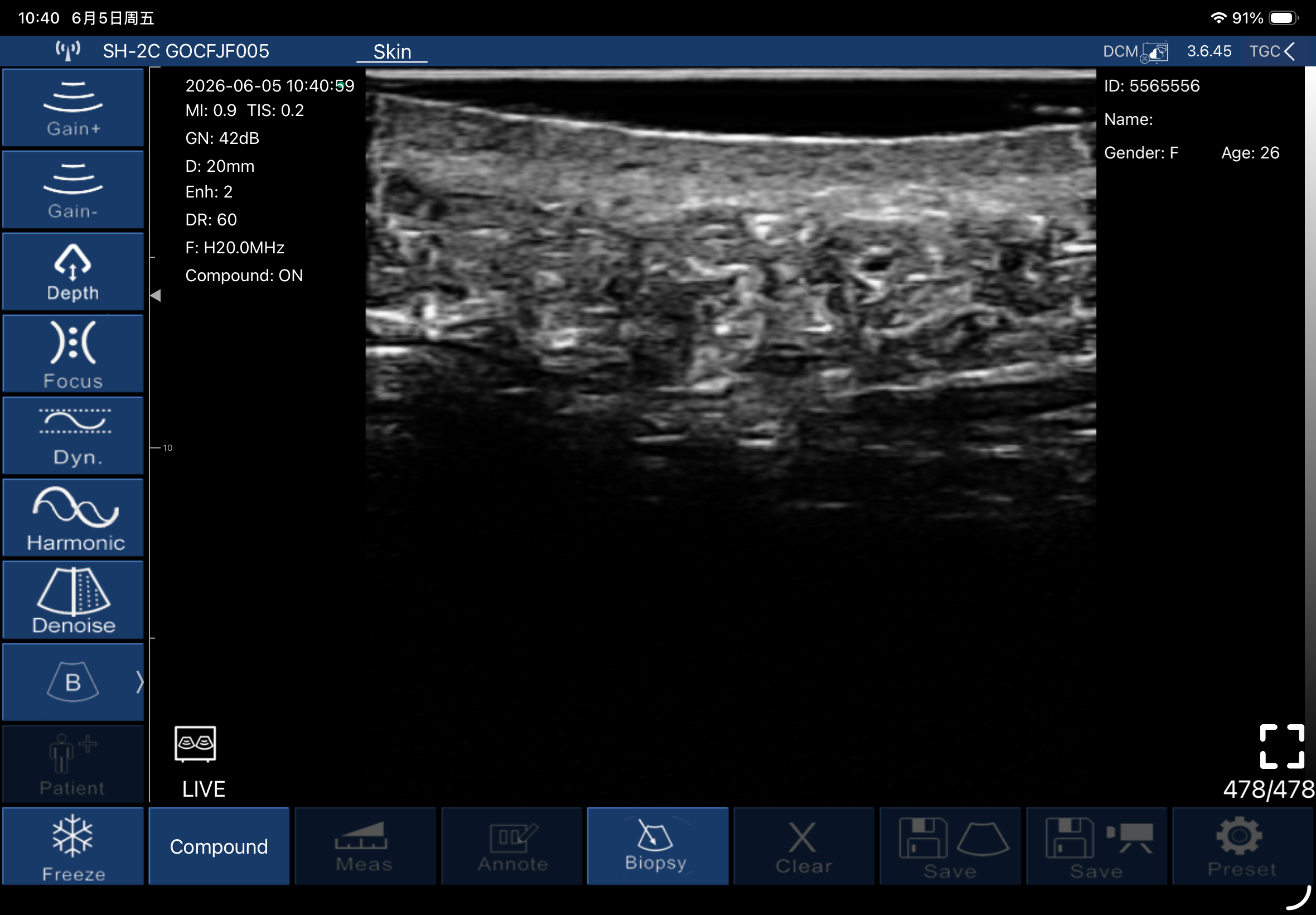Epidermis, dermis and subcutaneous tissue · B-mode · L20Pro · 20 MHz scan preview