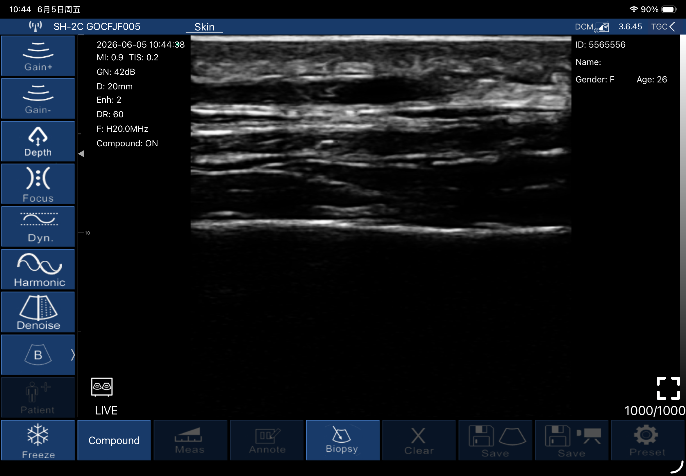 Subcutaneous tissue, longitudinal · B-mode · L20Pro · 20 MHz scan preview