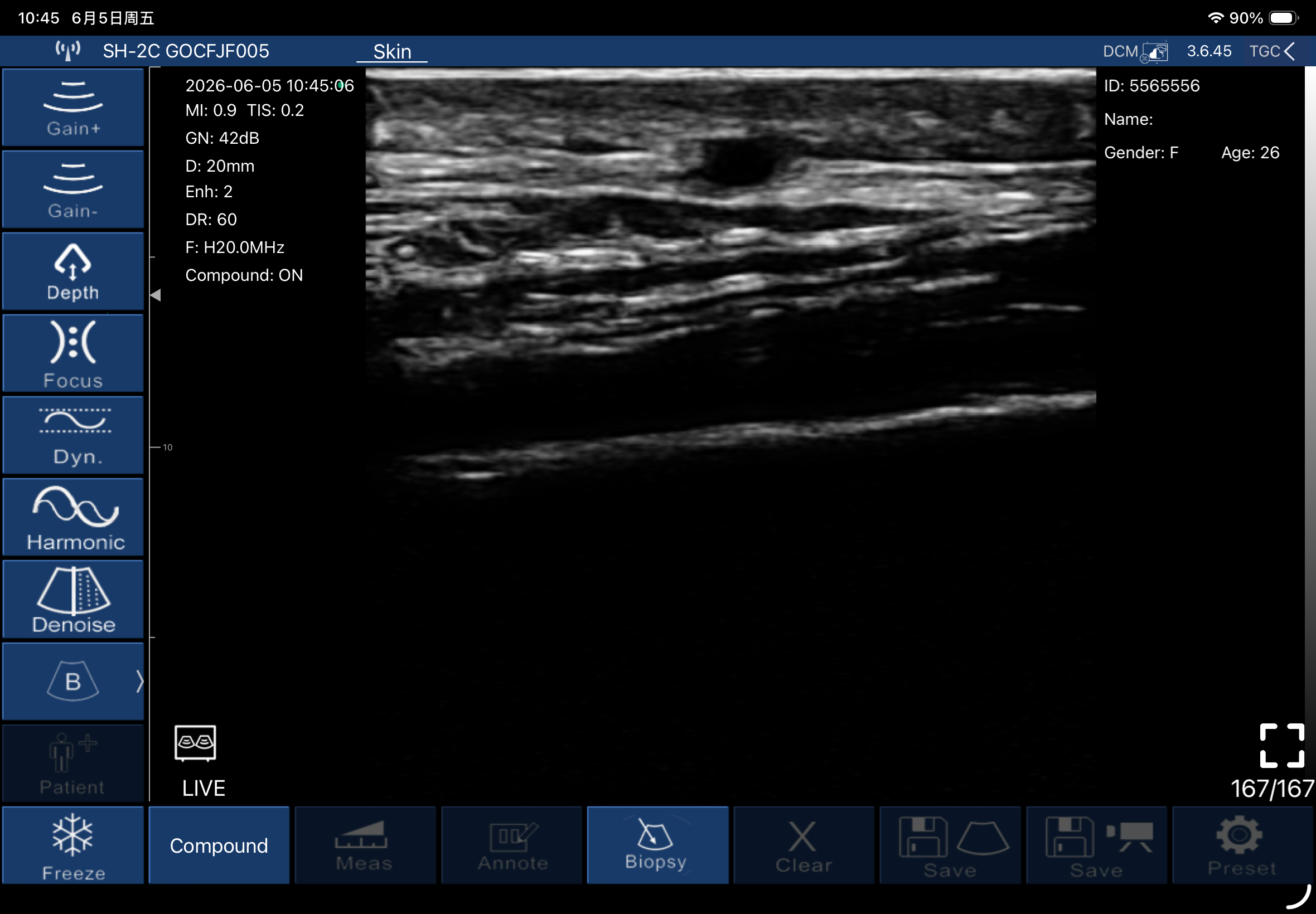 Epidermis, dermis and hypodermis · B-mode · L20Pro · Linear probe scan preview