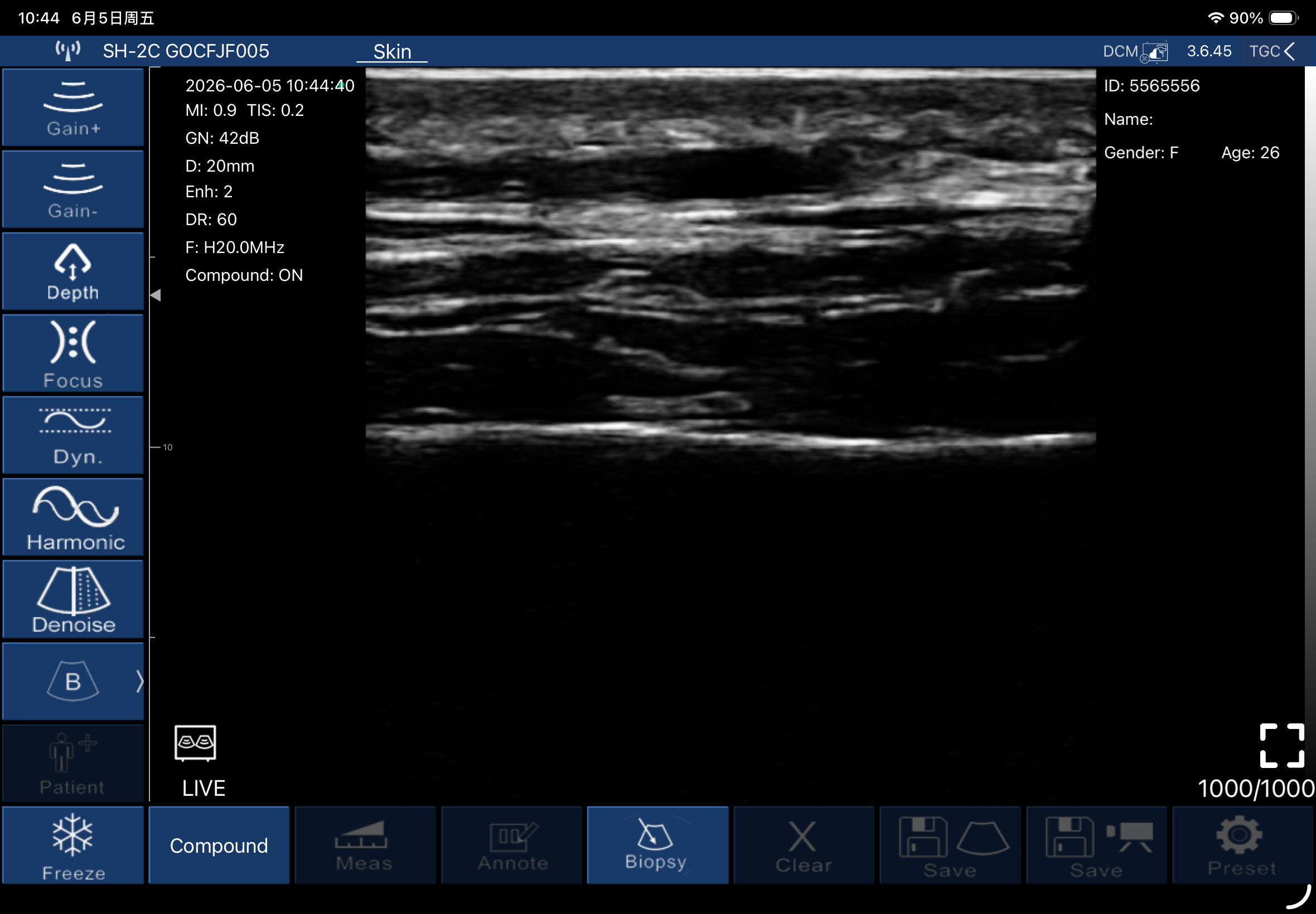 Epidermis to hypodermis, longitudinal · B-mode · L20Pro · Linear probe scan preview