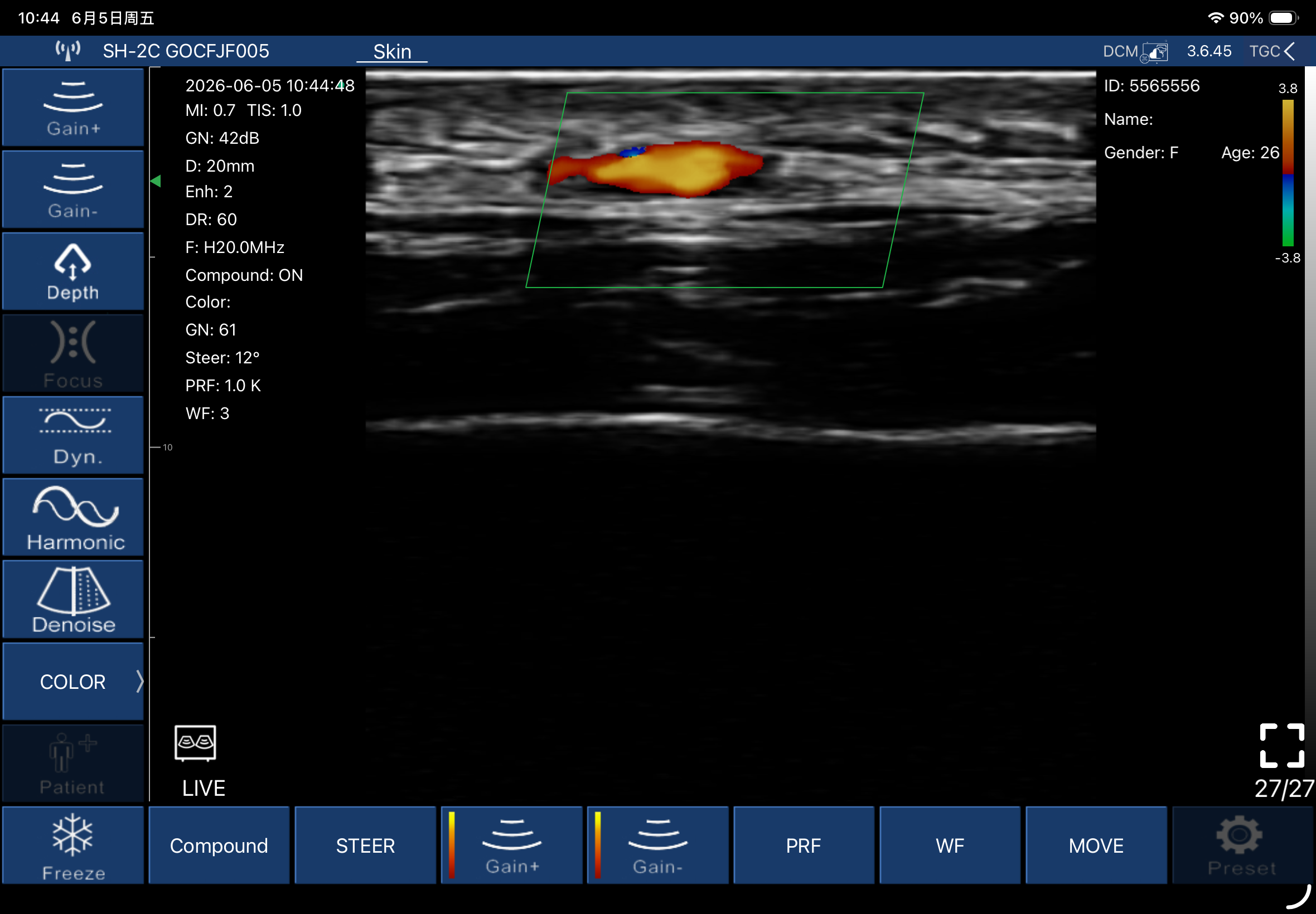Subcutaneous blood flow · Color Doppler · L20Pro · Linear probe scan preview