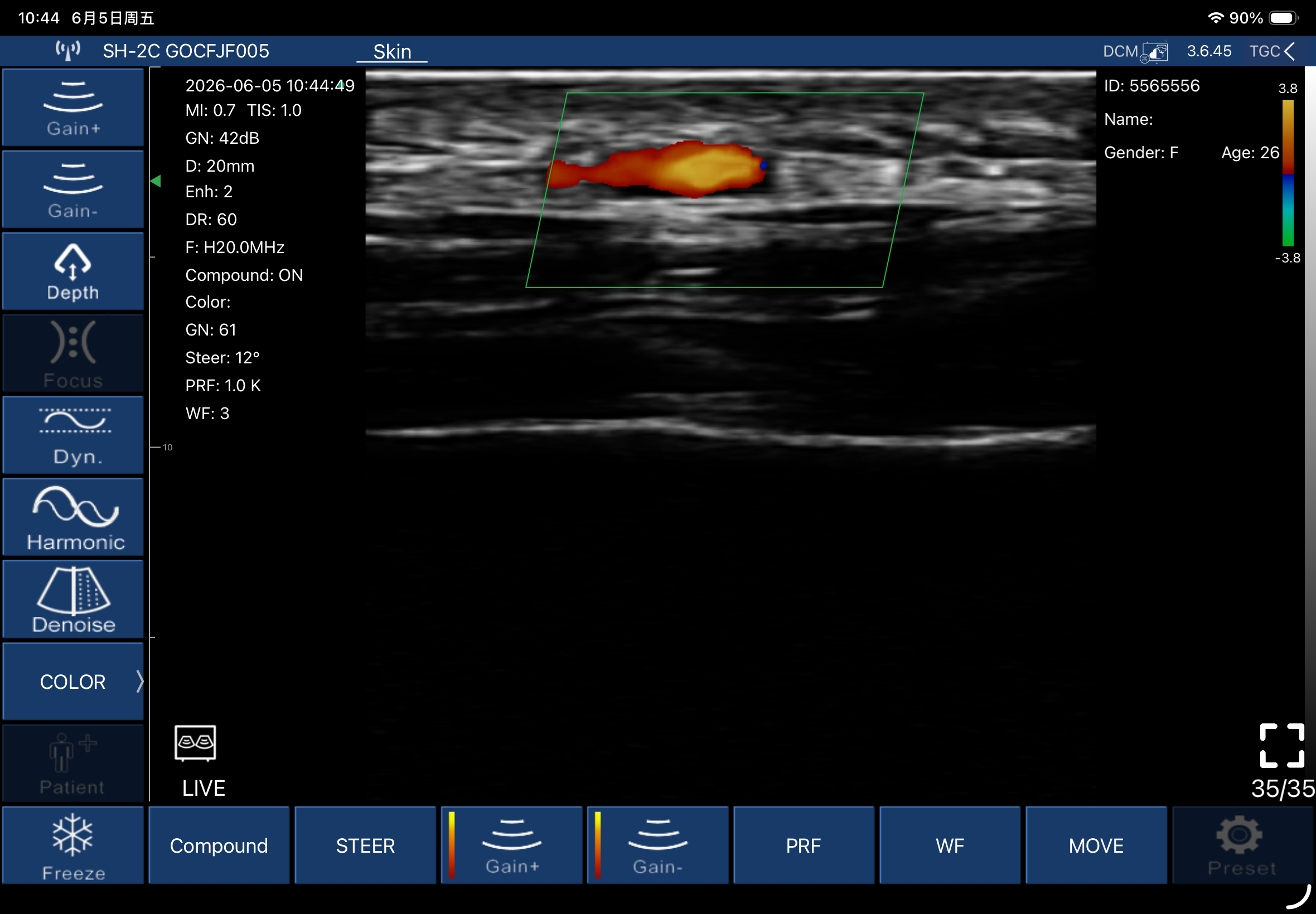 Superficial cutaneous vessel, longitudinal · Color Doppler · L20Pro scan preview