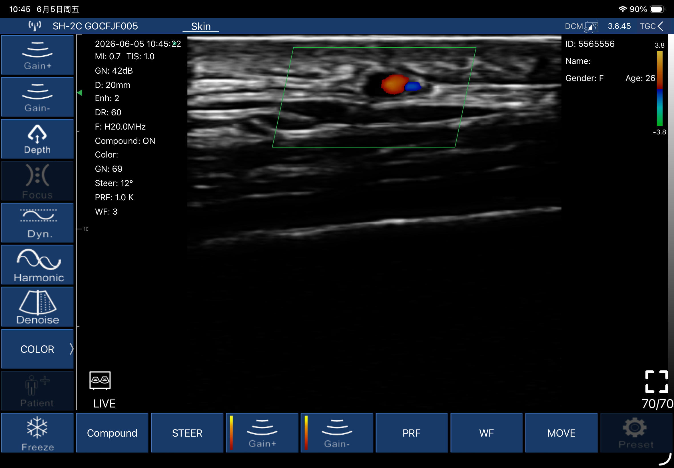 Superficial cutaneous vessels · Color Doppler · L20Pro · Linear probe scan preview