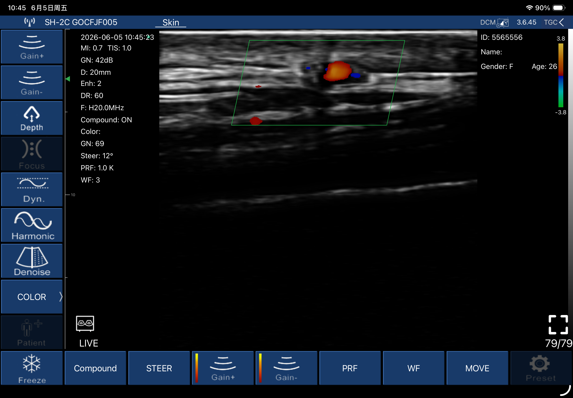 Dermal and subcutaneous vessels, transverse · Color Doppler · L20Pro scan preview