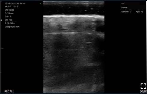 Nail unit · B-mode · L24Pro · Linear probe scan preview