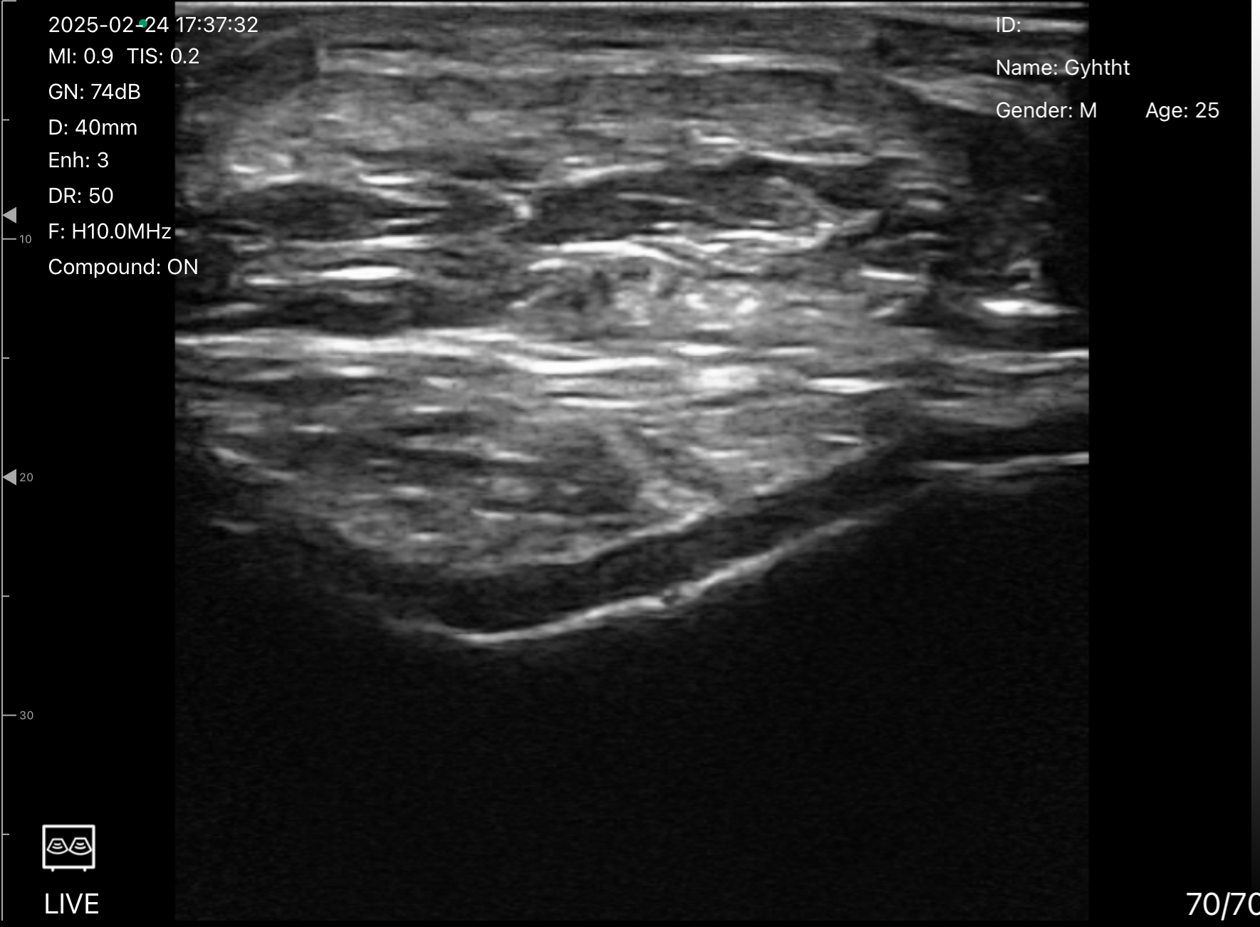 MSK soft tissue · B-mode · D3Ultra · 10 MHz scan preview