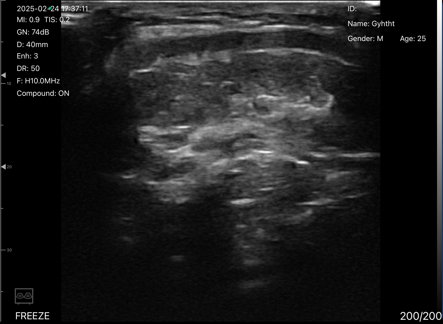 MSK soft tissue 2 · B-mode · D3Ultra · 10 MHz scan preview