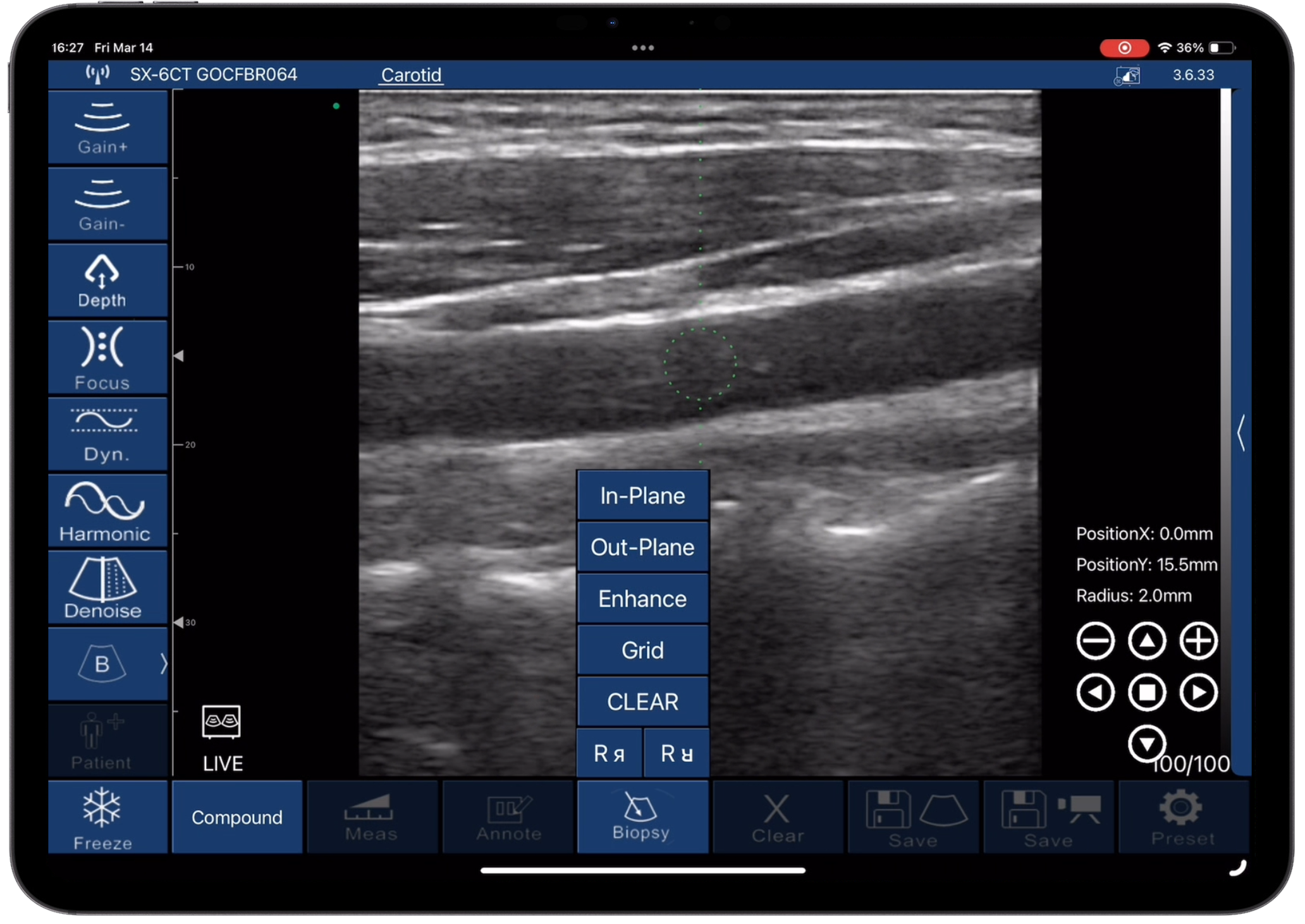 Needle guidance (Puncture Assist) · Software feature · D3Ultra scan preview