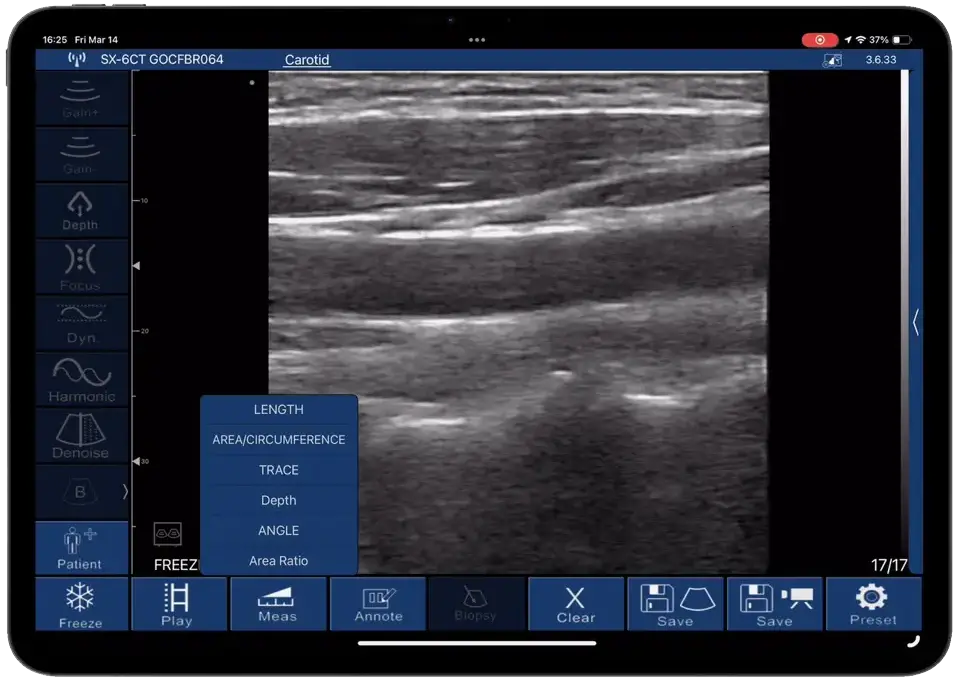 On-screen measurement tools · Software feature · D3Ultra scan preview