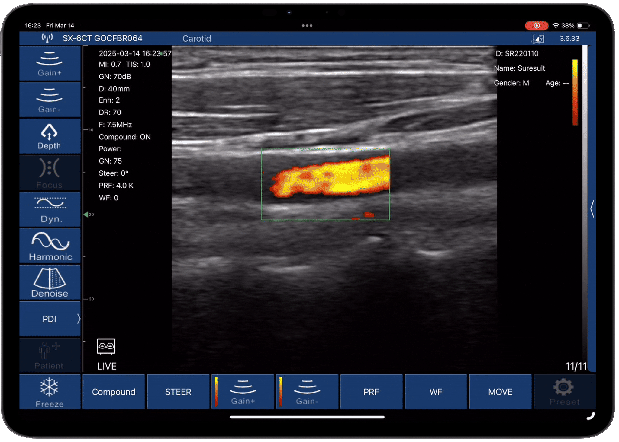 Scan modes and PW Doppler overview · Software feature · D3Ultra scan preview