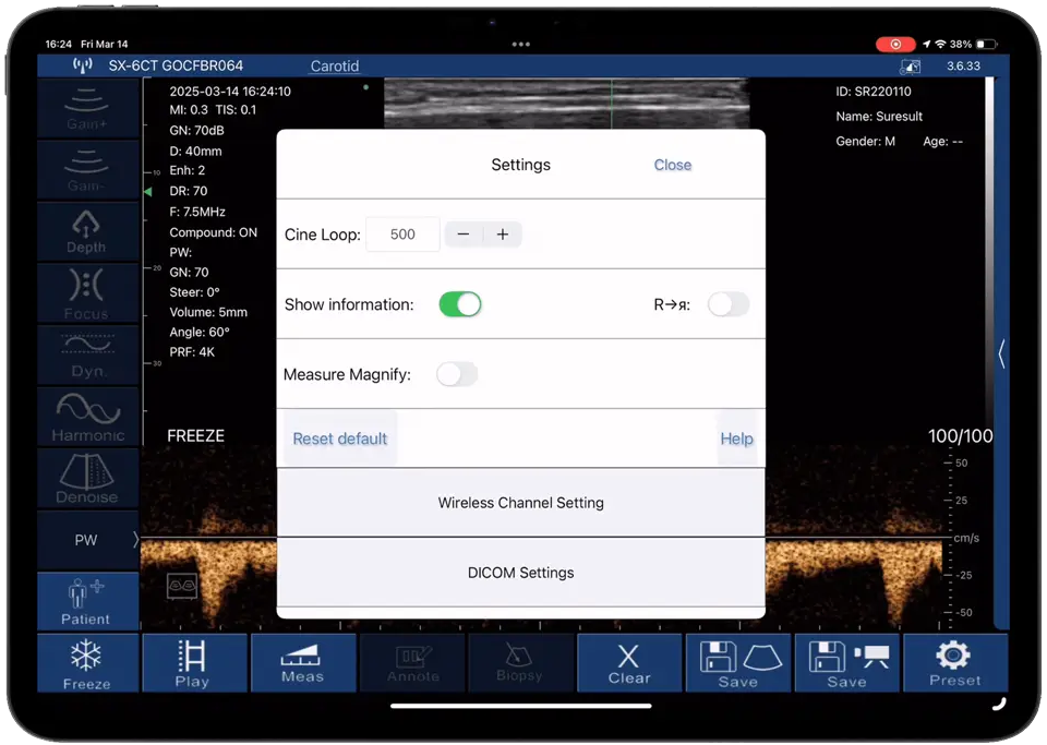 Extended cine loop · Software feature · D3Ultra scan preview