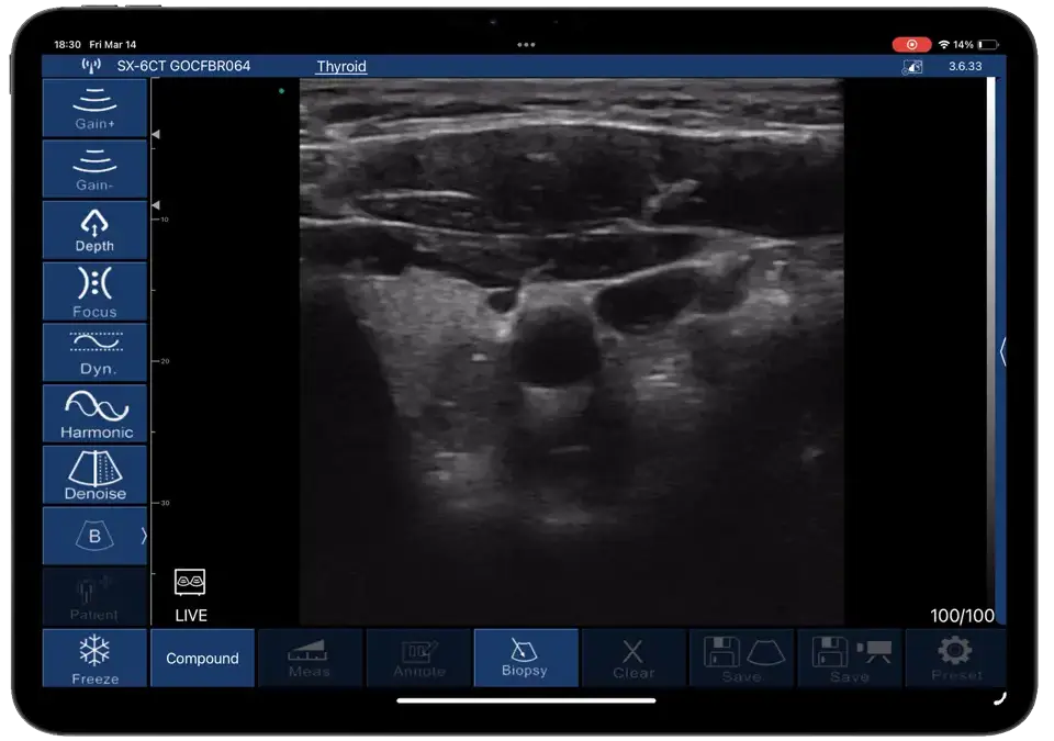 One-click freeze · Software feature · D3Ultra scan preview