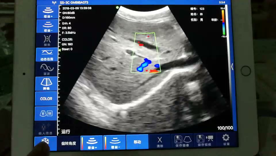 Abdomen · Color Doppler · C5SH · 3.5 MHz scan preview