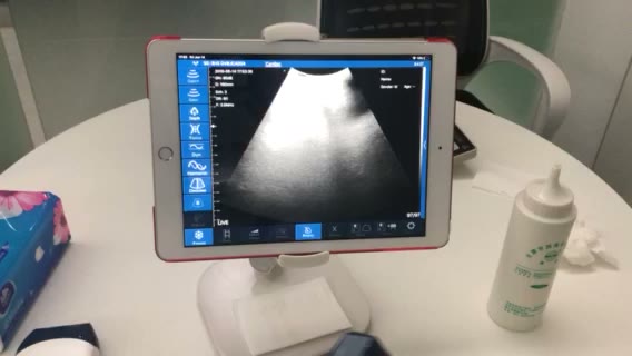 Convex probe scanning demo · Workflow · C5SH · Convex probe scan preview