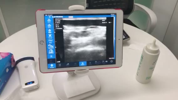 Linear probe scanning demo · Workflow · L10 · Linear probe scan preview