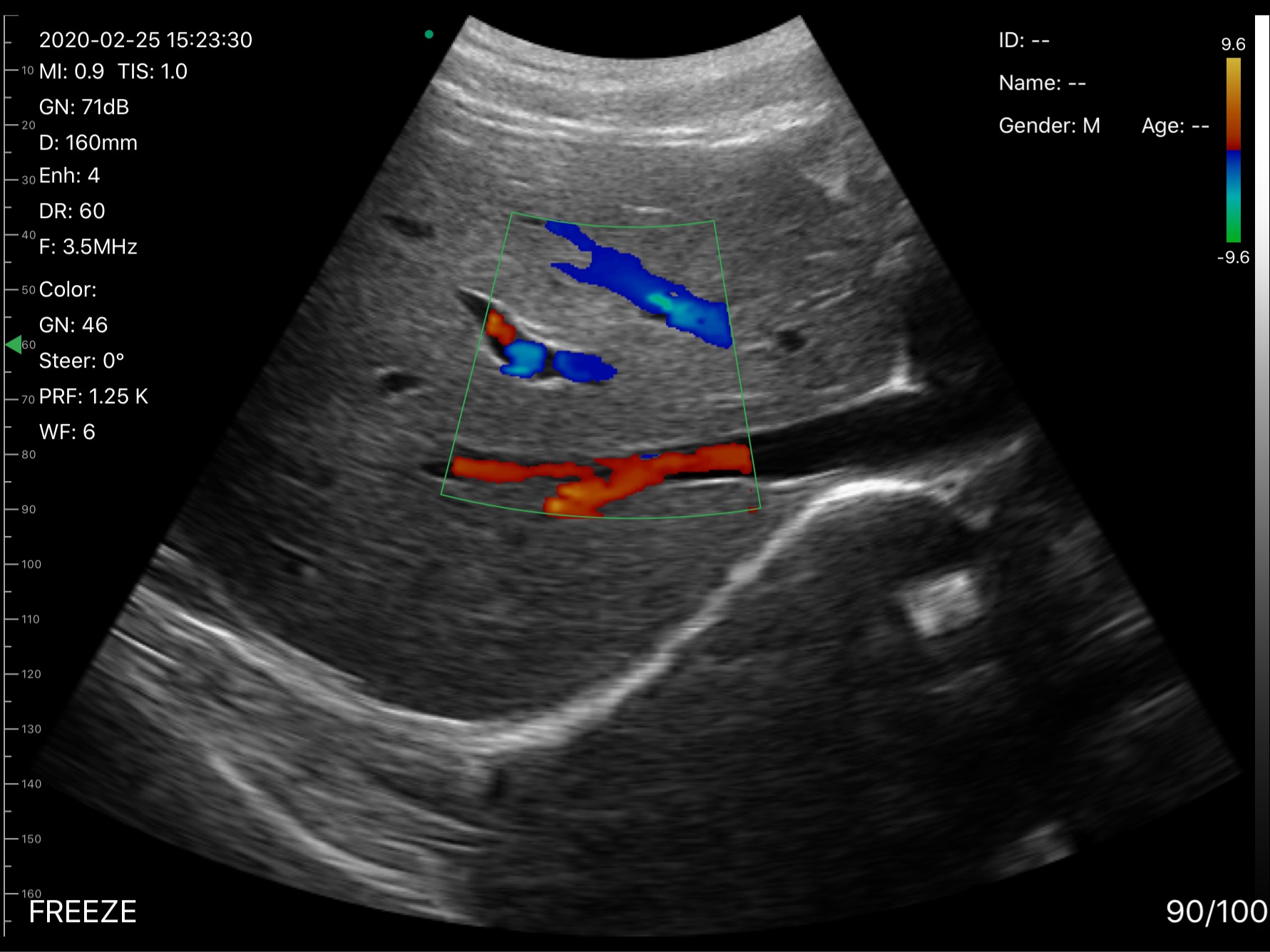 Portal and hepatic veins · Color Doppler · D3Pro · 3.5 MHz scan preview