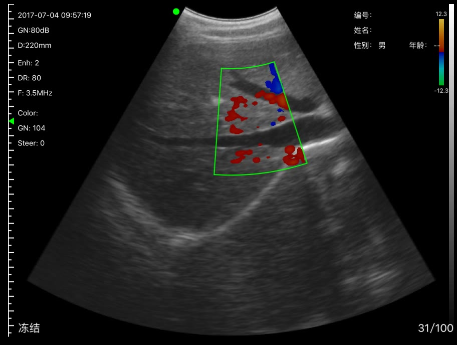Abdominal vessels · Color Doppler · C5SH · 3.5 MHz scan preview