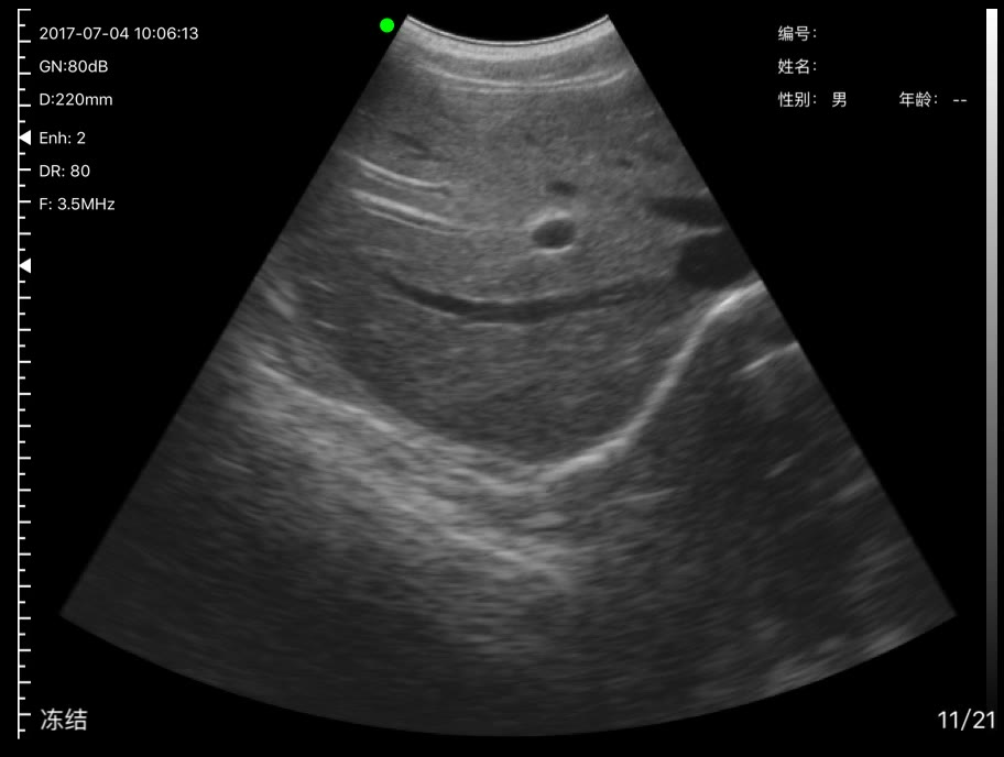Abdomen · B-mode · C5SH · 3.5 MHz scan preview