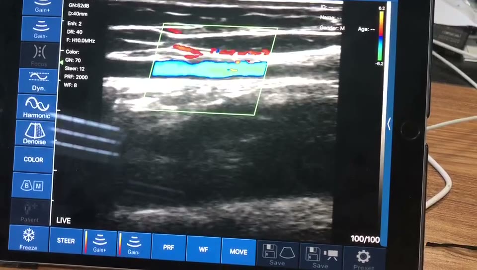Basilic vein and accompanying artery · Color Doppler · L10 · 10 MHz scan preview