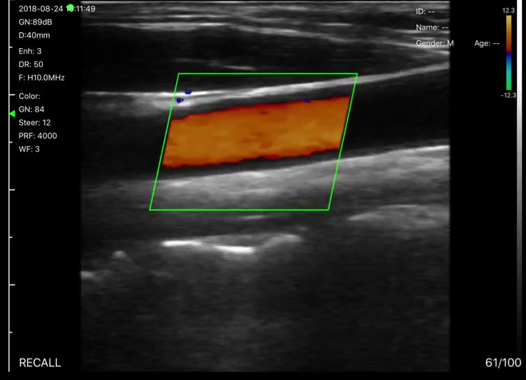 Superficial artery · Color Doppler · L10 · 10 MHz scan preview