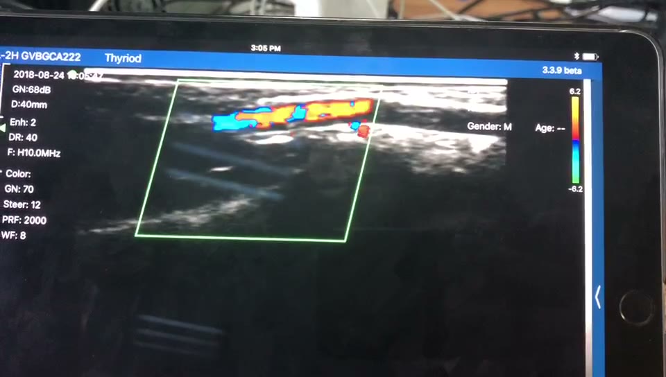 Superficial forearm artery · Color Doppler · L10 · 10 MHz scan preview