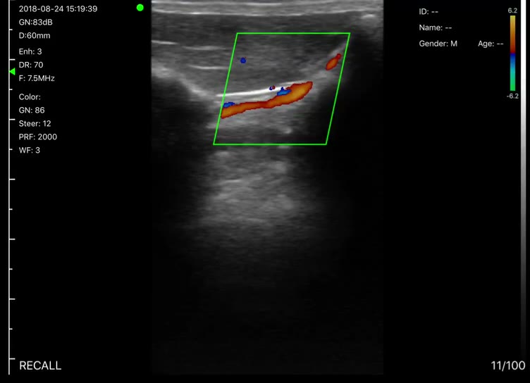 Superficial artery · Color Doppler · L10 · 7.5 MHz scan preview