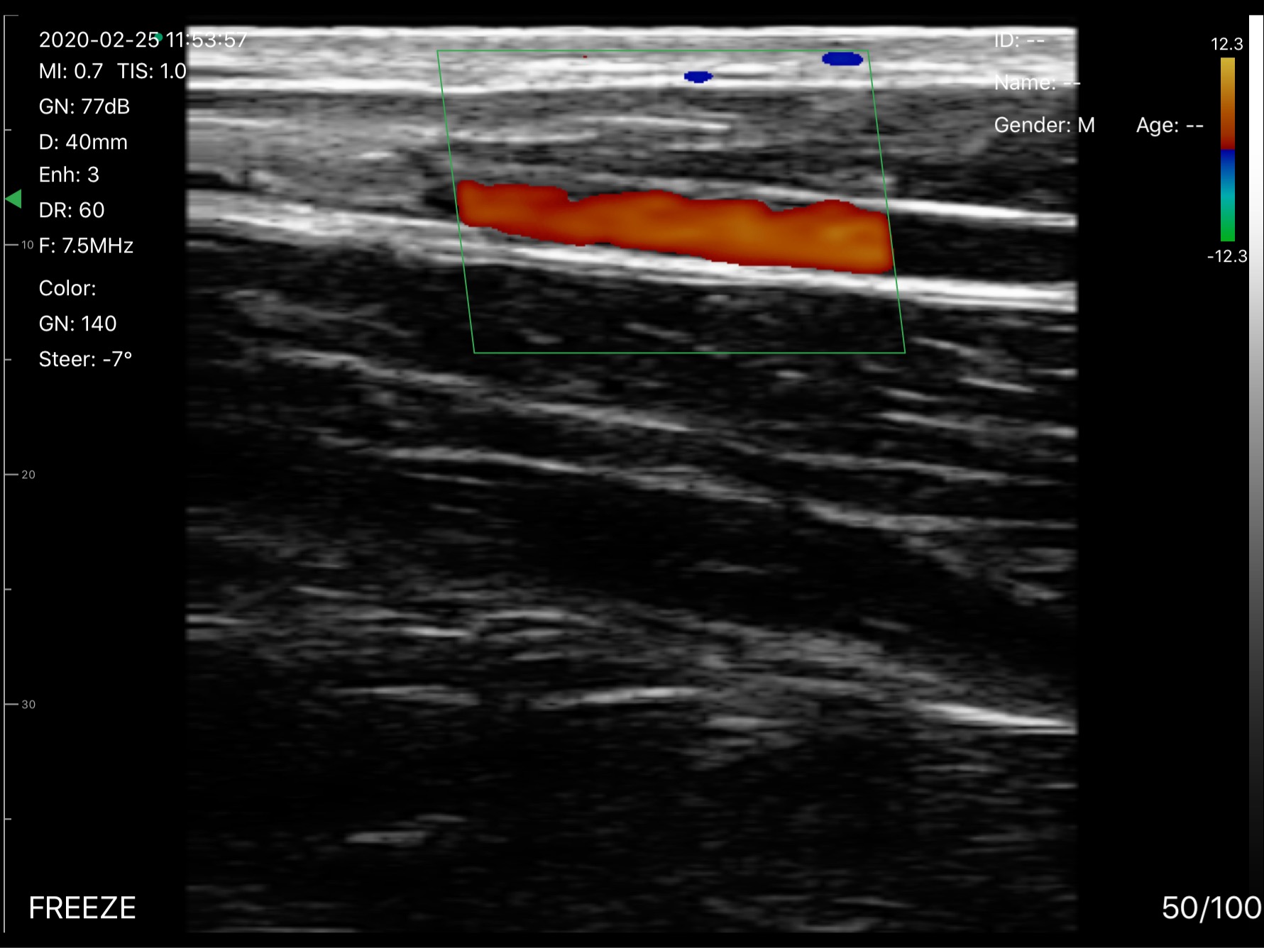 Wrist artery · Color Doppler · D3Pro · Linear probe scan preview