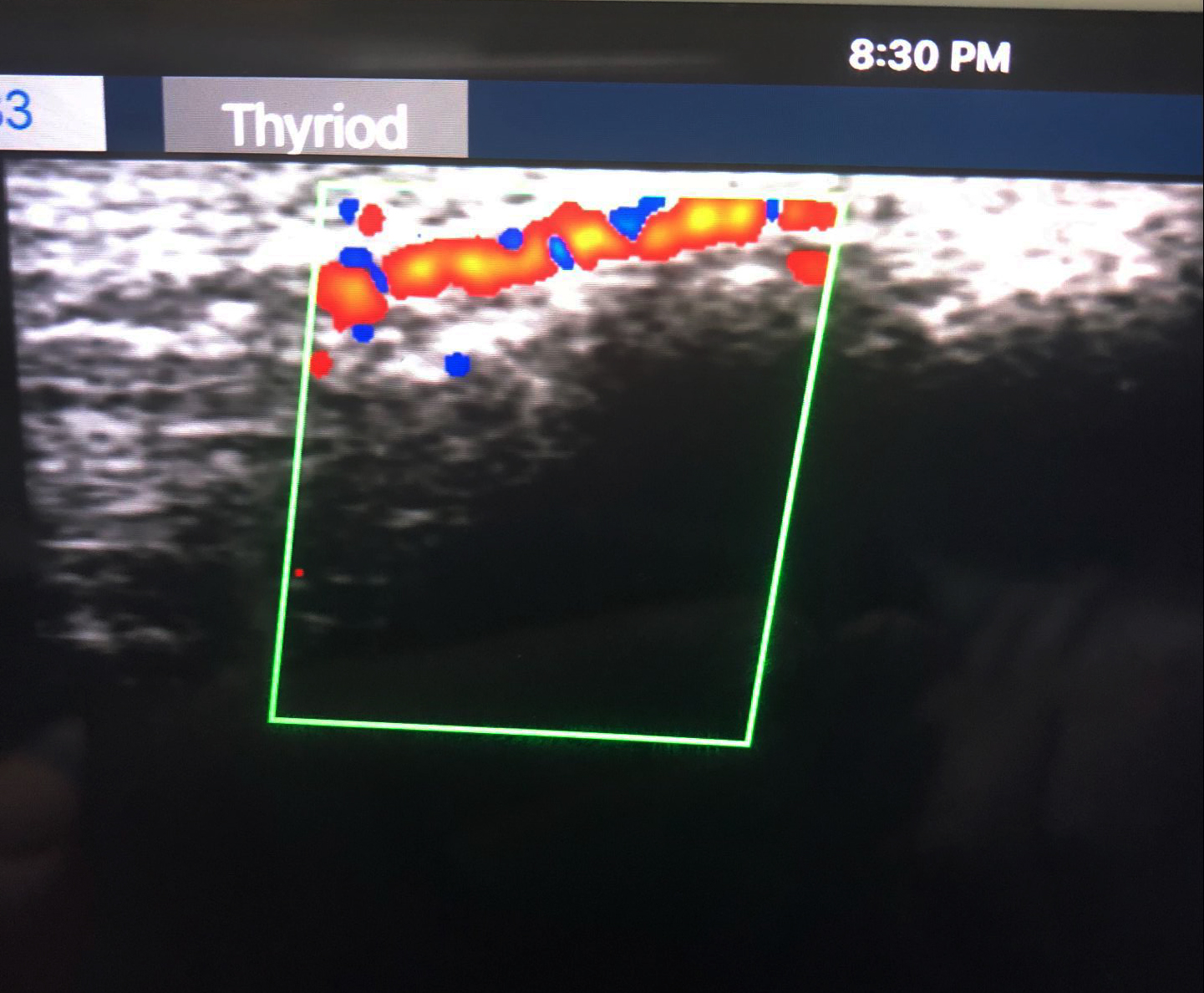 Superficial vessel · Color Doppler · L10 · 10 MHz scan preview