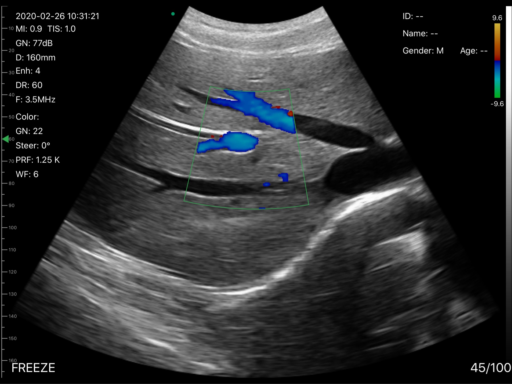 Hepatic veins 2 · Color Doppler · D3Pro · 3.5 MHz scan preview