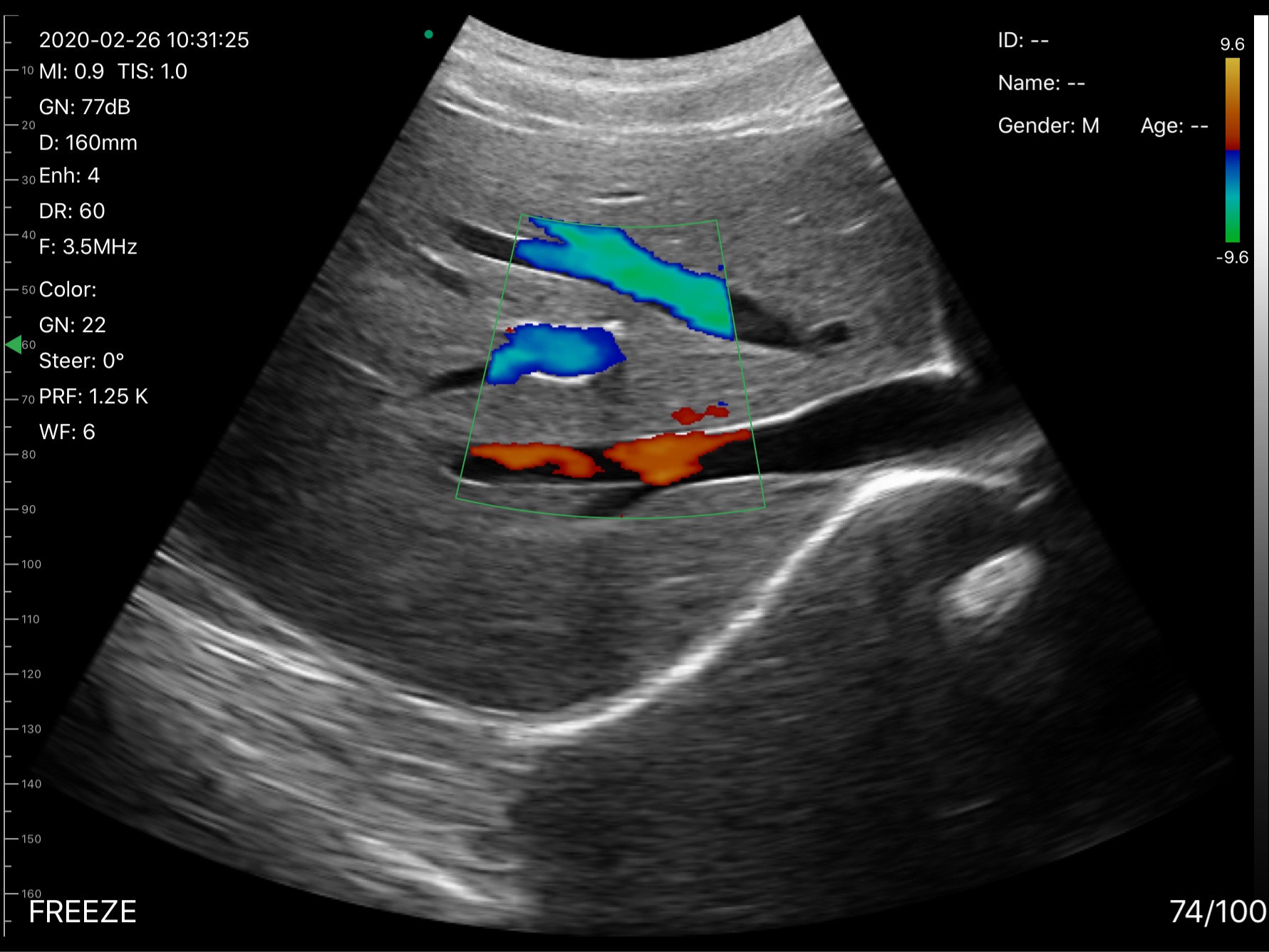 Hepatic veins · Color Doppler · D3Pro · 3.5 MHz scan preview