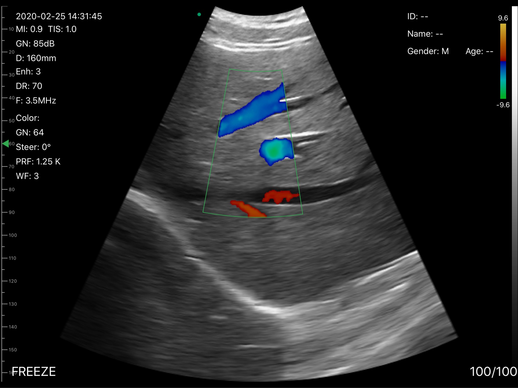 Liver vessels · Color Doppler · D3 · Convex probe scan preview