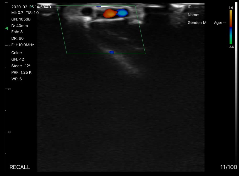 Wrist vessel · Color Doppler · D3 · Linear probe scan preview